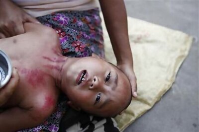 Malaria makes you smell delicious to mosquitoes