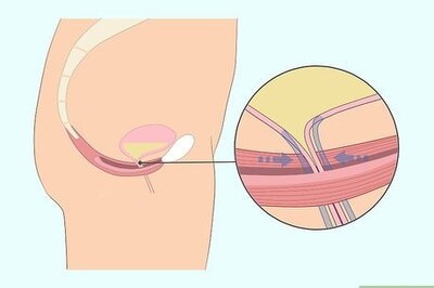 How to Do Kegel Exercises