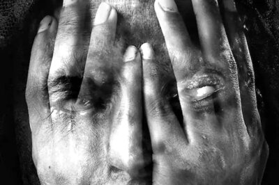 Three Dalit Girls Attacked with Acid in UP’s Gonda, Accused Arrested after Encounter with Police