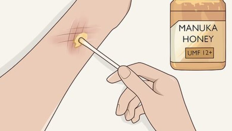 How to Use Honey as a Topical Antibiotic