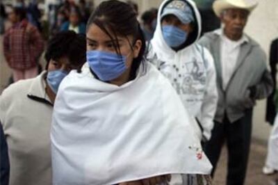 FAQs: What you should know about Swine flu