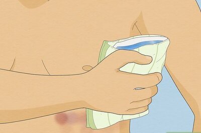 14 Ways to Treat Bruised or Cracked Ribs