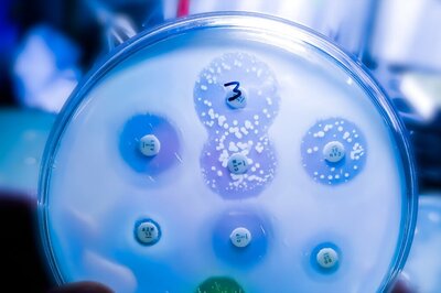 7.5 Lakh Deaths Linked to Anti-Microbial Resistance Every Year in Low & Middle-Income Countries Are Preventable, Reveals Lancet Study