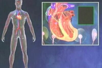 What is a bypass surgery