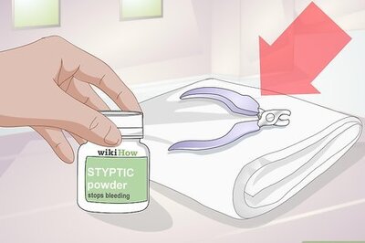 How to Trim Rabbit Toenails