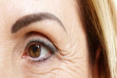 Age is Not The Only Reason; Avoid These Factors To Get Rid of Wrinkles