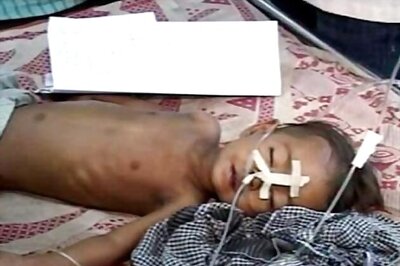 Encephalitis claims 623 lives eastern UP this year