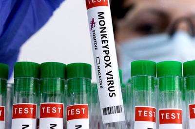 Monkeypox Outbreak: India's First Patient 'Fully Cured'; Spain Reports 2nd Death | What We Know So Far