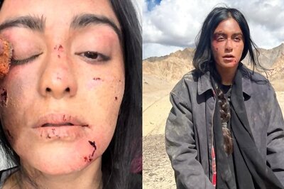 Adah Sharma's 'Wounded' Photos From The Kerala Story's Afghanistan Shoot Will Shock You