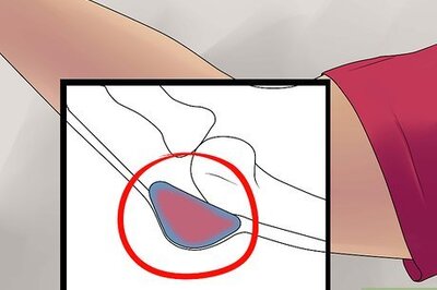 How to Treat Bursitis