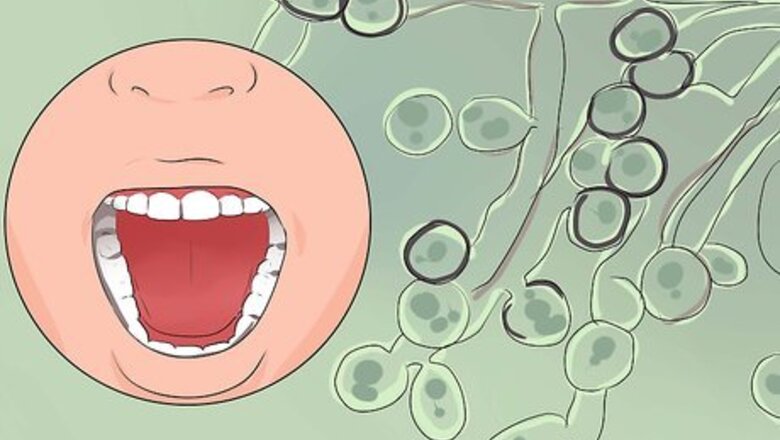 How to Treat Thrush