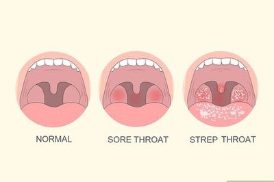 How to Tell if You Have Strep Throat