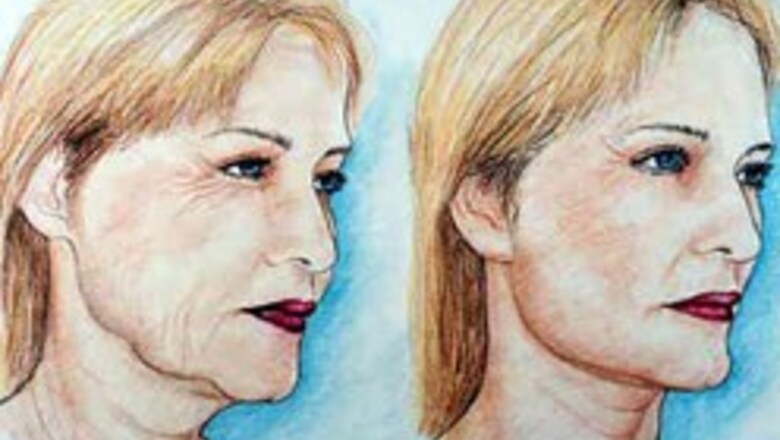 Want a facelift? Head for Pakistan