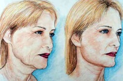 Want a facelift? Head for Pakistan