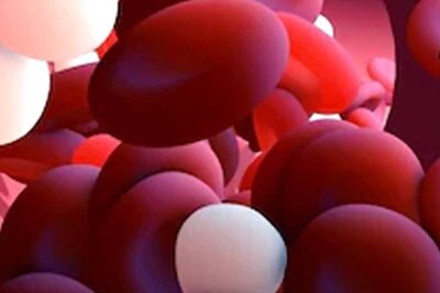 What Are The Symptoms Of Blood Clotting? A Look At Home Remedies To Prevent It