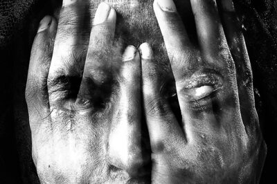 Jilted Nurse Attacks Doctor With Acid in Tirupati Court, Consumes the Rest