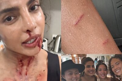 Priyanka Chopra Says Doing Action Movies Is ‘Glamorous’; Shares Her Injuries, Blood-Stained Videos