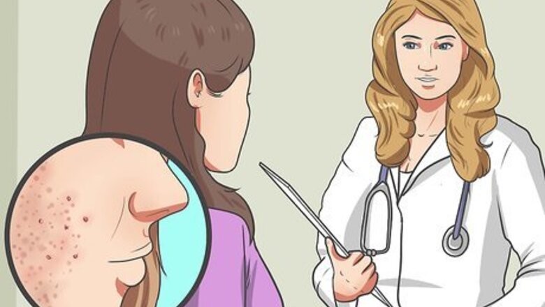 How to Start Using Accutane