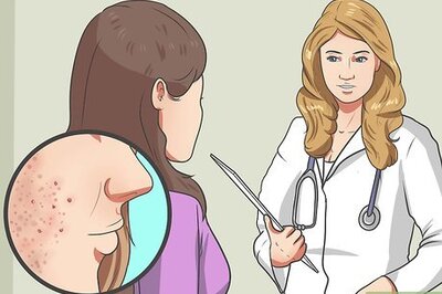 How to Start Using Accutane