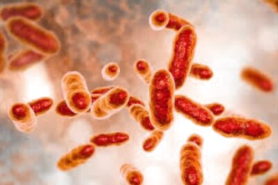 Brucellosis: All You Need to Know About China's New Rapidly Spreading Bacterial Infection