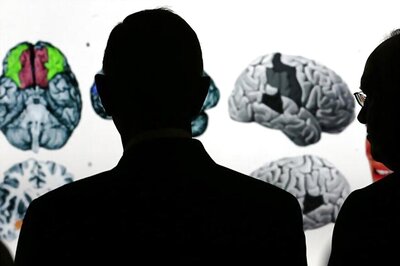 Huntington's Disease? Dysfunction In Brain Structure Can Cause It