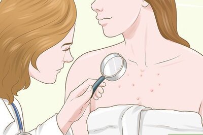 How to Get Rid of Acne Scars on Your Chest