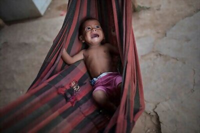 Virus-linked hunger tied to 10,000 child deaths each month