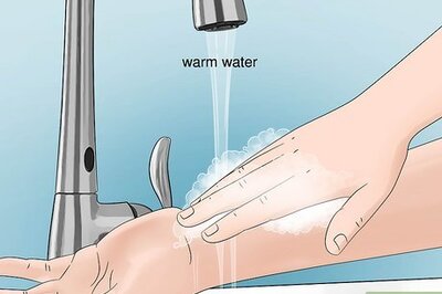 How to Treat Flea Bites