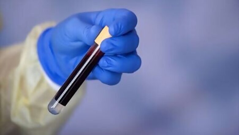 Only 8% of people in German coronavirus hotspot had COVID-19, study finds