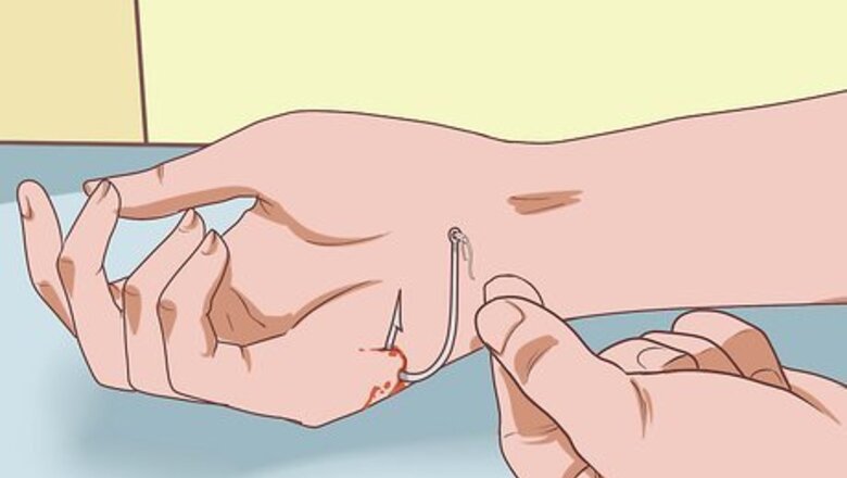 How to Remove a Fishhook from Skin