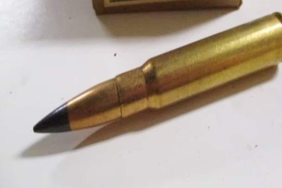 Man, 21, Parties For Four Days Without Realising There Is A Bullet Stuck In His Head