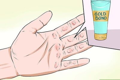 How to Prevent Calluses on Hands