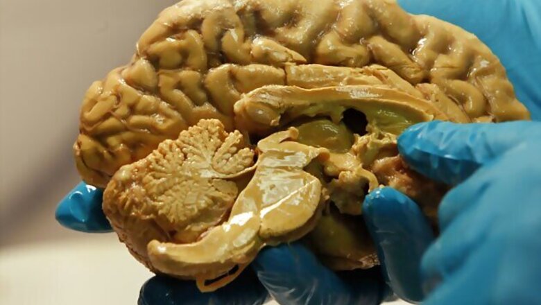 Found! Cells that drive brain's adaptability