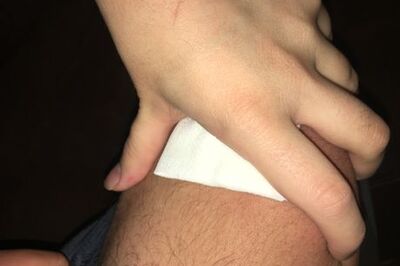 How to Make Saline Solution to Clean a Wound