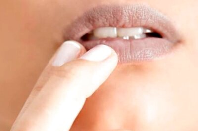 5 Experts Ways to Soothe Your Dry Lips and Eyelids in Winters