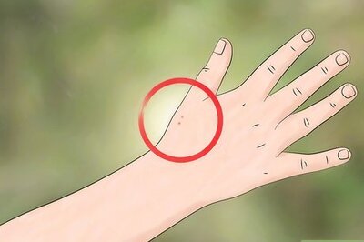 How to Identify and Treat Black Widow Spider Bites