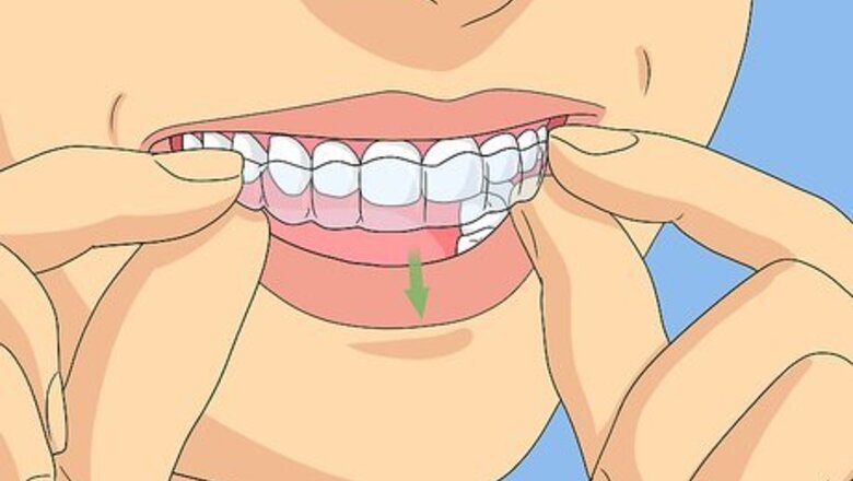 How to Clean Invisalign