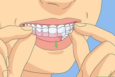 How to Clean Invisalign
