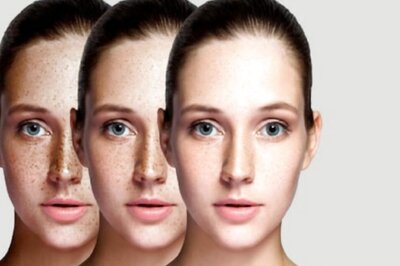 What Causes Dark Spots and Pigmentation on Face