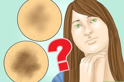 How to Prevent Hyperpigmentation of the Skin