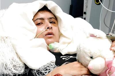 Malala's condition stable: Doctors