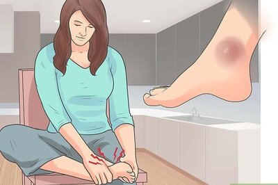 Foot Fractures: Treatment, Symptoms & More